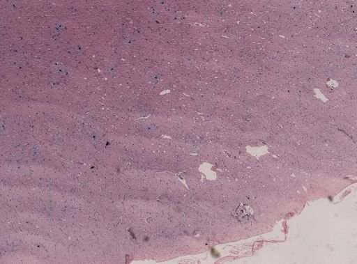 Plasmodium falciparum