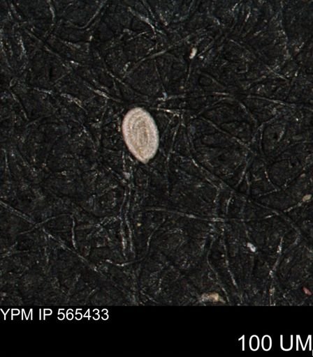 Spirolocammina planula