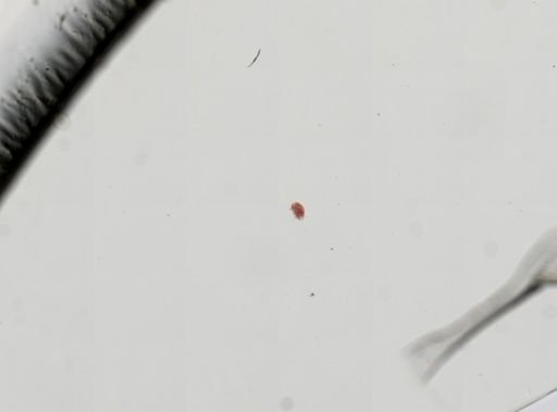 Trematoda