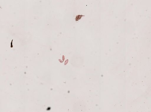 Paramecium aurelia
