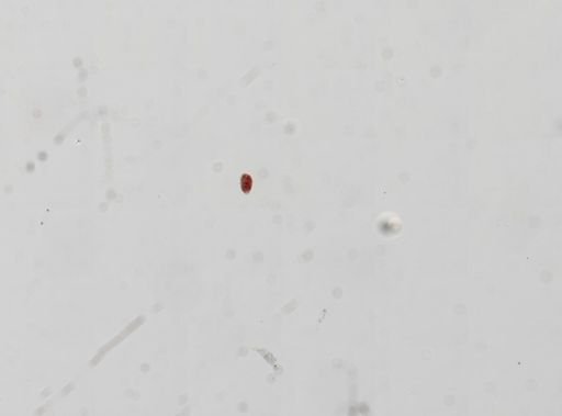 Trematoda