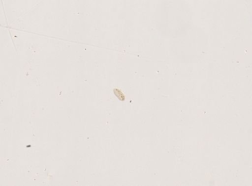 Paramecium calkinsi