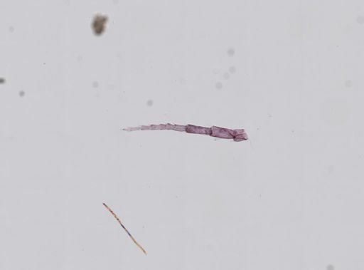 Hyalella cf. azteca