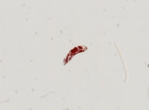 Trematoda