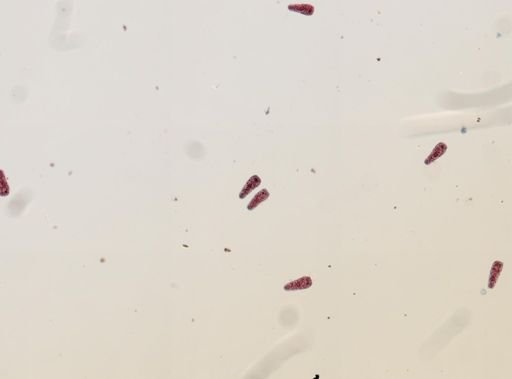 Fasciola hepatica