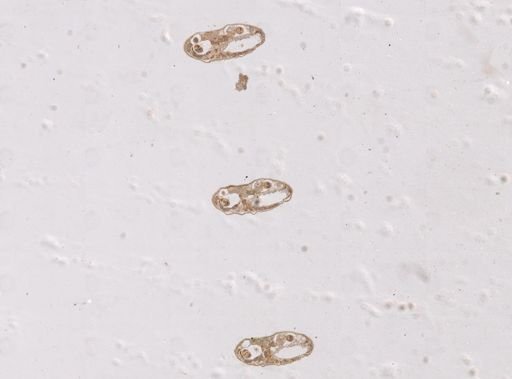 Paravortex gemellipara