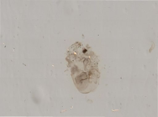 Asterias?