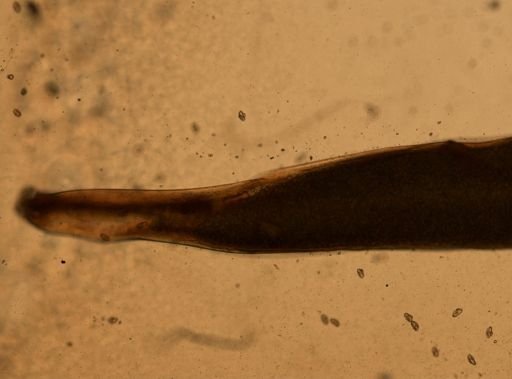 Enterobius vermicularis