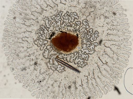 Daktulosphaira vitifoliae