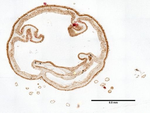 Scyphozoa