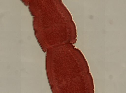 Dipylidium caninum