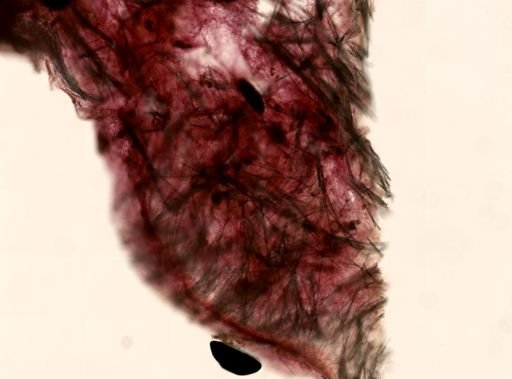 Tedania suctoria