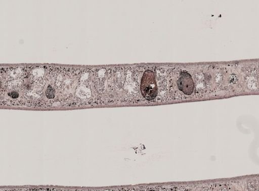 Pleioplana atomata