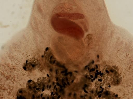 Fasciola hepatica
