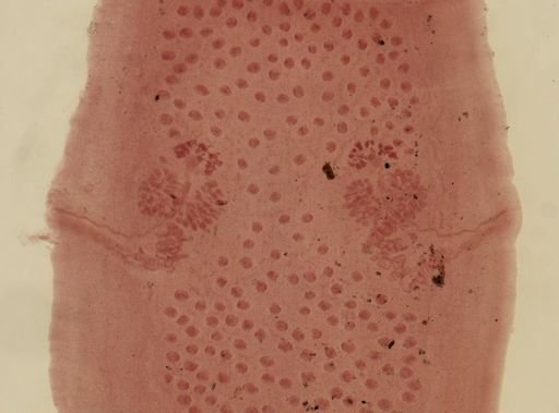 Dipylidium caninum