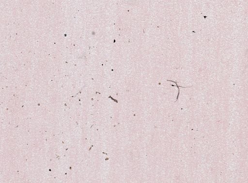 Plasmodium vivax