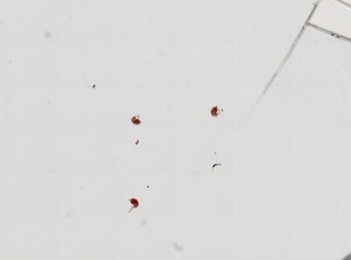 Trematoda