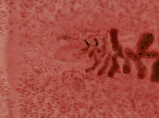 Diphyllobothrium latum