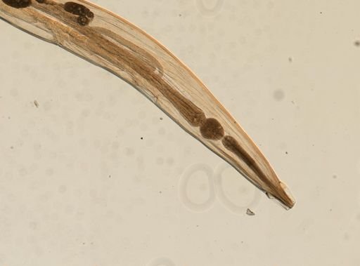 Enterobius vermicularis
