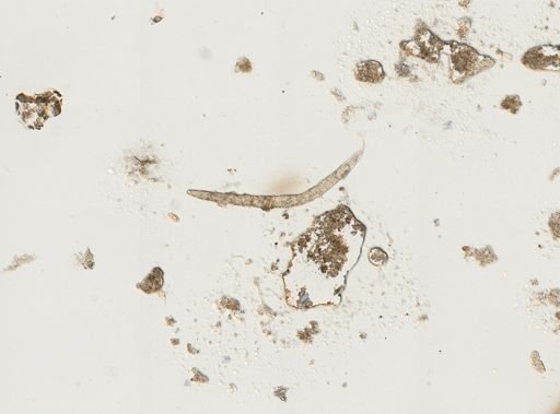 Strongyloides stercoralis