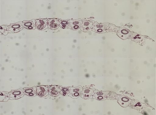 Watersipora nigra