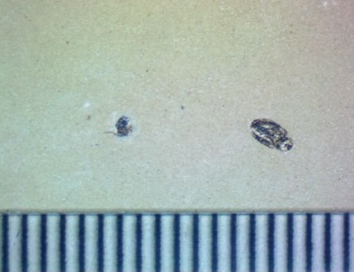 undet. Hexapoda