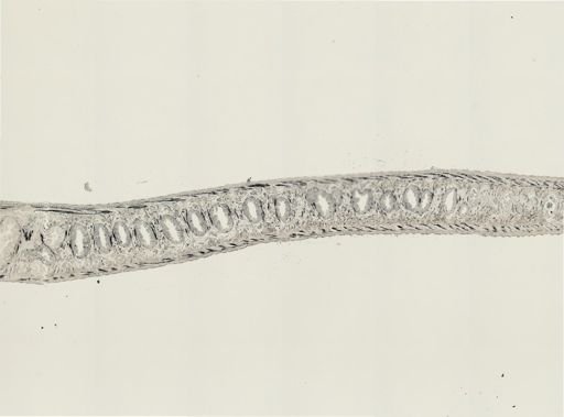 Turbellaria