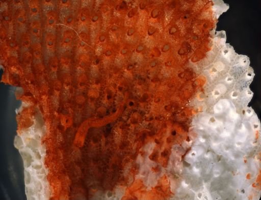 Bryozoa