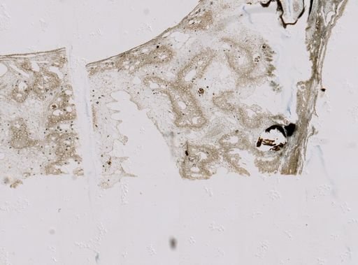 Pseudoceratina purpurea