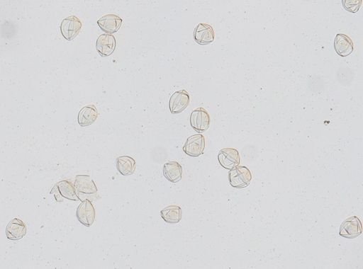Hymenolepis diminuta