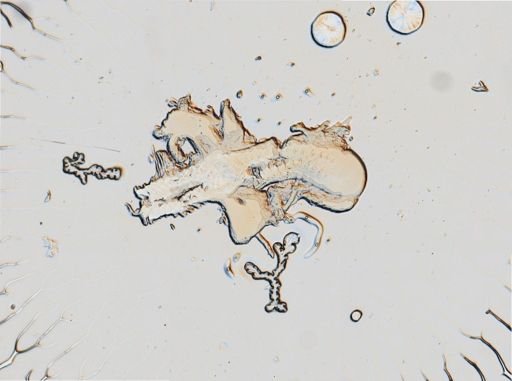Onchidoris muricata