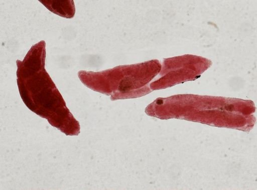 Fasciola hepatica
