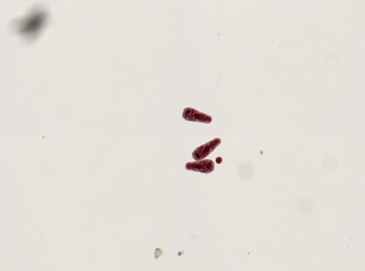 Fasciola hepatica