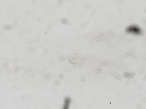 Hymenolepis diminuta