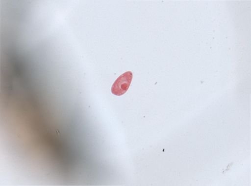 Paramecium aurelia