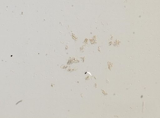 Somatogyrus depressus