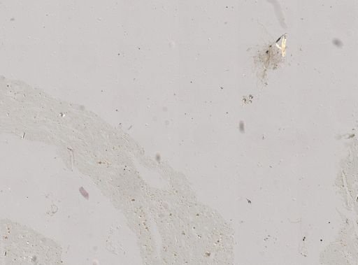 Tetractinellida?