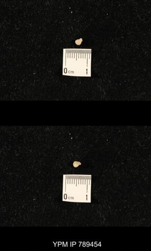 undet. Bryozoa