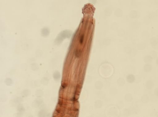 Oligacanthorhynchus microcephalus
