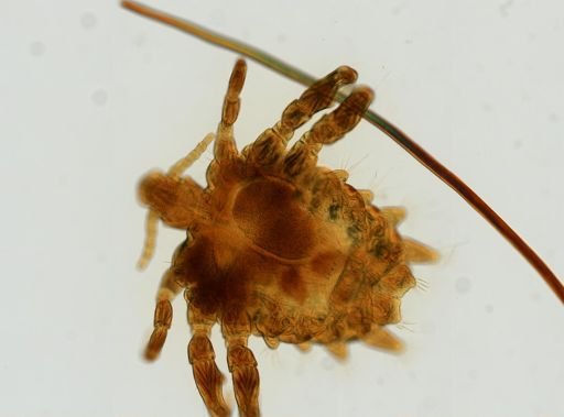 Pthirus pubis