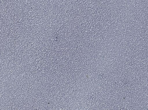 Plasmodium vivax