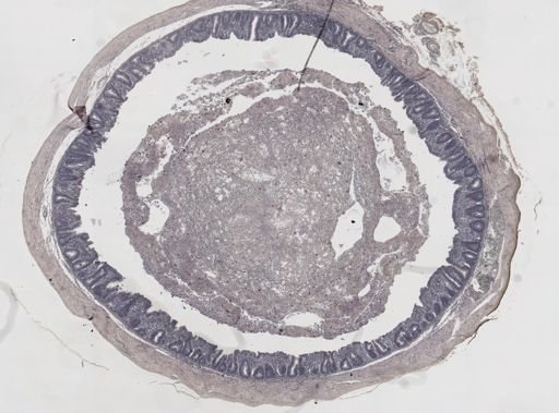 Eimeria meleagrimitis