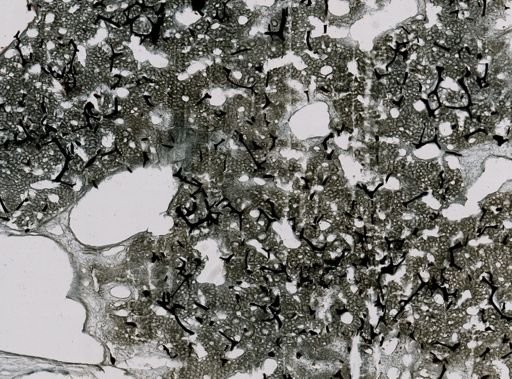 Spongia irregularis