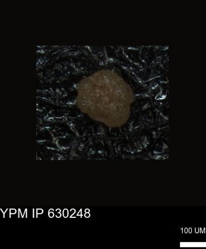 undet. Foraminiferida