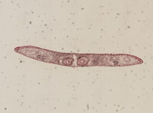 Phagocata gracilis