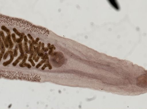 Clonorchis sinensis