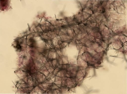 Ectyoplasia ferox