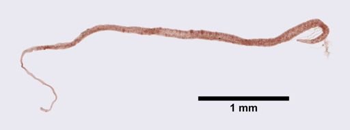 Distomum haematobium
