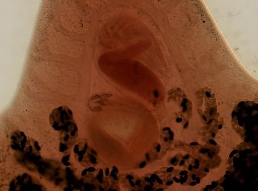 Fasciola hepatica
