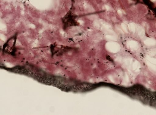 Ircinia